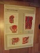   Original Plakat (Poster): Anatomische Bildtafel. CIBA-Geigy. "Niere und Harnwege". Plakat in Farbe ca. 48,5 x 67,0 cm. 