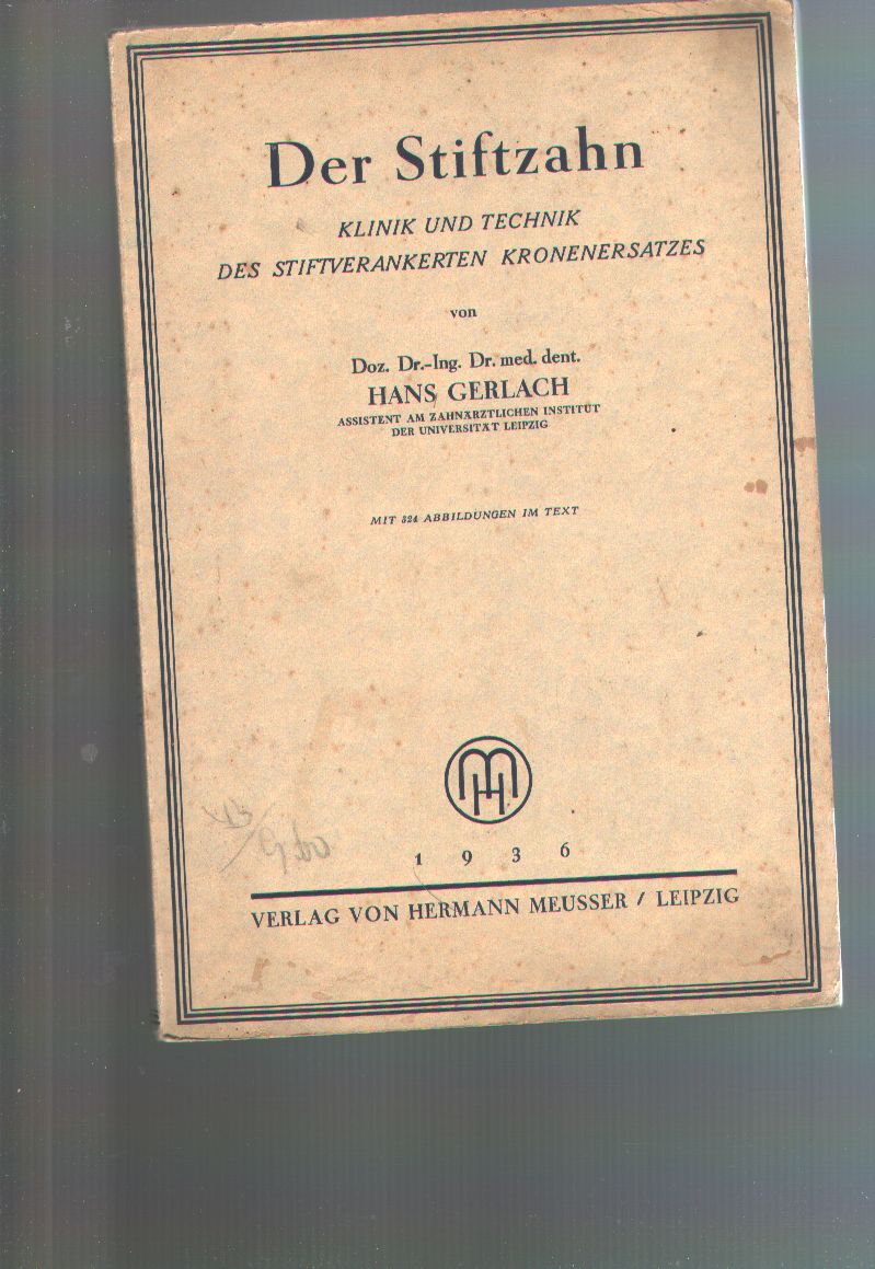 Dr. Hans Gerlach  Der Stiftzahn   Klinik und Technik des Stiftverankerten Kronenersatzes 