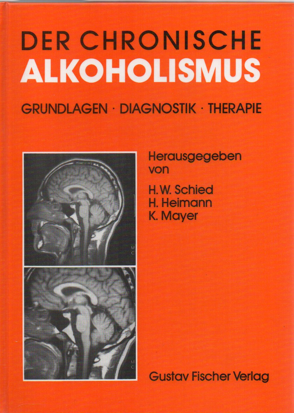 Schied,H.W.+H.Heimann+K.Mayer(Hsg.)  Der chronische Alkoholismus.Grundlagen.Diagnostik.Therapie 