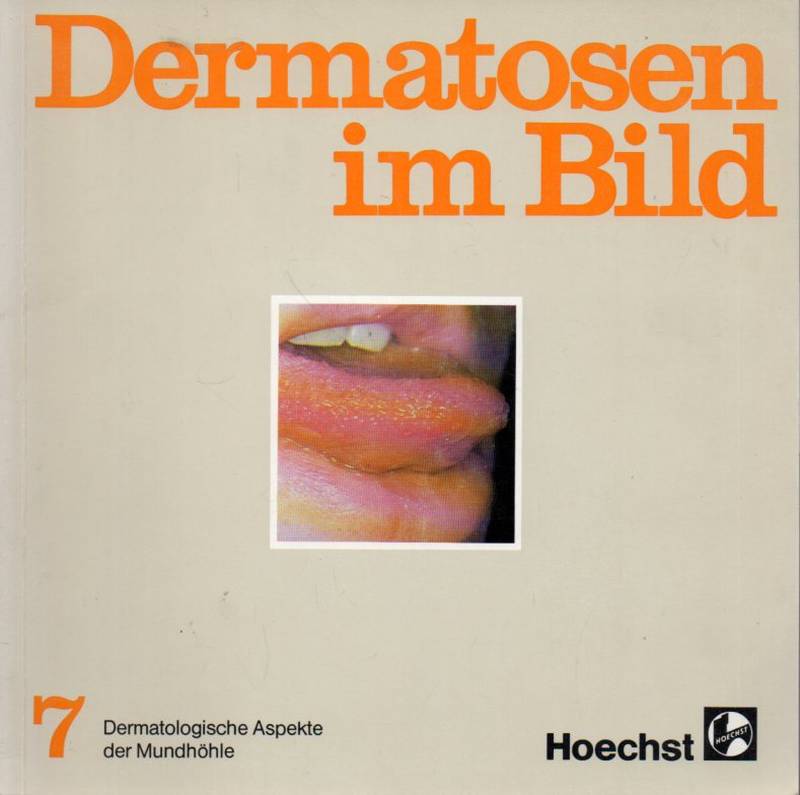 Hornstein,O.P.  Dermatologische Aspekte der Mundhöhle 