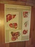   Original Plakat (Poster): Anatomische Bildtafel. CIBA-Geigy. "Leber und Gallenwege". Plakat in Farbe ca. 48,5 x 67,0 cm. 