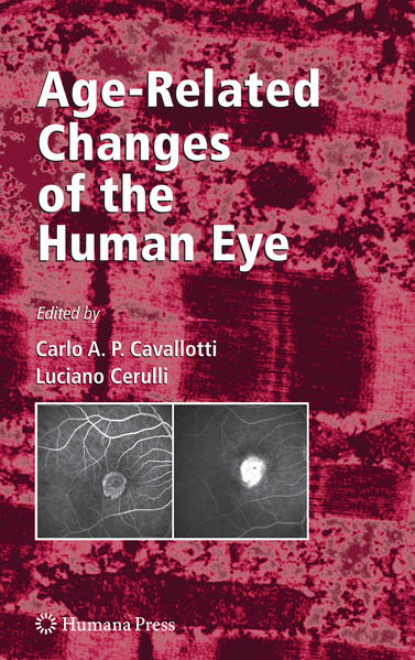 Cavallotti, Carlo and Cerulli,  Luciano (Eds.):  Age-Related Changes of the Human Eye (Aging Medicine). 