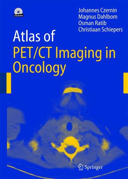 Czernin, Johannes, Magnus Dahlbom and O. Ratib:  Atlas of PET/CT Imaging in Oncology. 