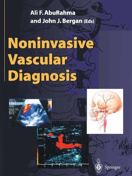 AbuRahma, Ali F. and John J. Bergan [Eds.]:  Noninvasive vascular diagnosis. 