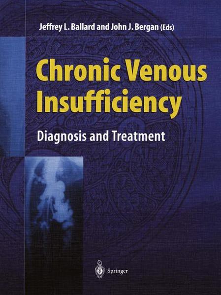 Ballard, Jeffrey L. and John Bergan:  Chronic Venous Insufficiency. Diagnosis and Treatment. 