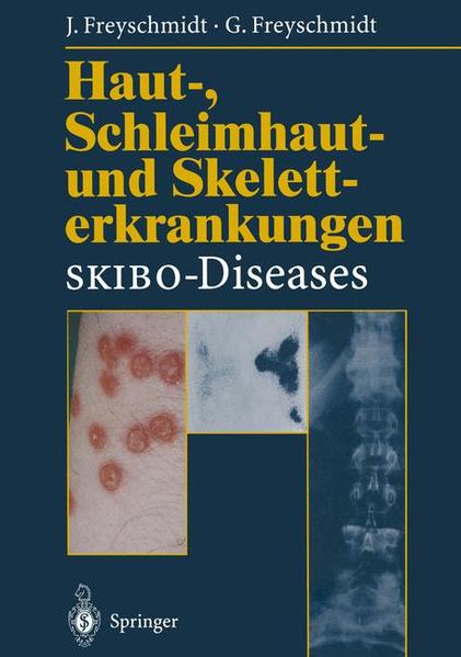 Freyschmidt, Jürgen und Gisela Freyschmidt:  Haut-, Schleimhaut- und Skeletterkrankungen. SKIBO-diseases. Eine dermatologisch-klinisch-radiologische Synopse. 