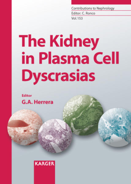 Herrera, G.A.:  The Kidney in Plasma Cell Dyscrasias. [Contributions to Nephrology, Vol. 153]. 