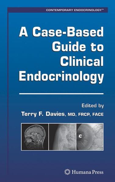 Davies, Terry (Ed.):  Modern Cases in Endocrinology and Diabetes. (=Contemporary Endocrinology). 