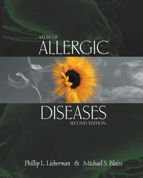 Lieberman, Phillip L. and Michael S. Blaiss:  Atlas of Allergic Diseases. 