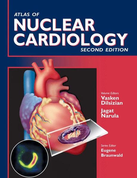 Dilsizian, Vasken and Jagat Narula:  Atlas of Nuclear Cardiology. 