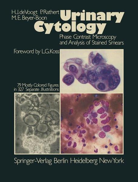 Voogt, Herman J. de, Peter Rathert and Mathilde E. Bayer-Boon:  Urinary cytology : phase contrast microscopy and analysis of stained smears. 